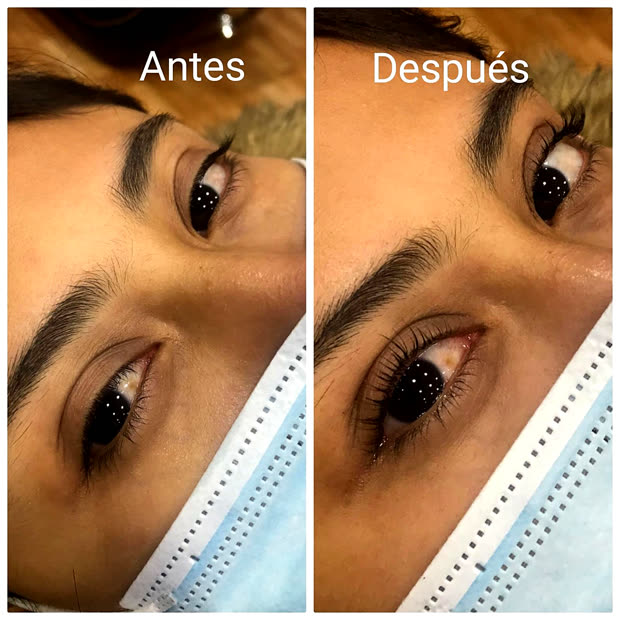 La misma ceja antes y después del diseño, vista de lado
