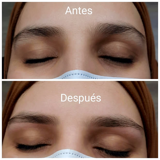 Las dos cejas antes y después, de frente y con los ojos cerrados